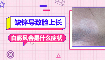兒童脖頸有白斑一直擴散用什么方法控制