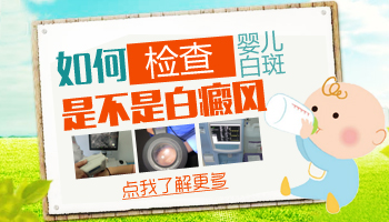 腿上有白癜風照308激光是怎么收費的