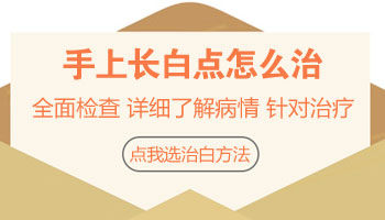 嘴角有白癜風照308激光一次多少錢