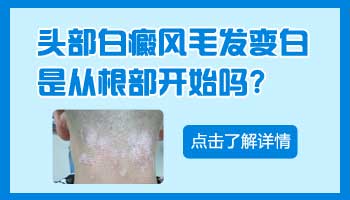 7個月孩子腰部有一小塊白斑照伍德燈顯熒光是不是白癜風
