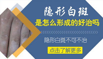 4個月孩子后背黃豆大白斑照伍德燈顯熒光是不是白癜風