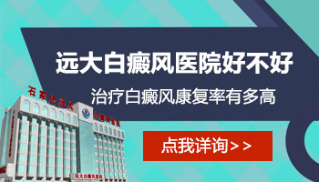 腰部有白斑照308激光多久一次,一次多少錢