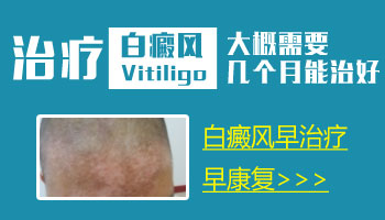7個月孩子脖子黃豆大白斑照伍德燈亮白色是不是白癜風