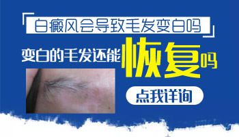 嬰幼兒胸部有白斑照308準分子激光多久能好