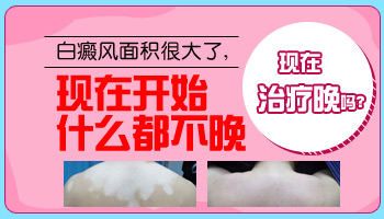 7個月孩子胸部有白點照308激光多長時間有好轉