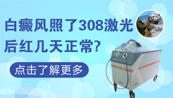 手指有白斑照308激光按什么收費
