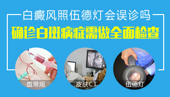 兒童鼻子有白點擦他克莫司能治好嗎