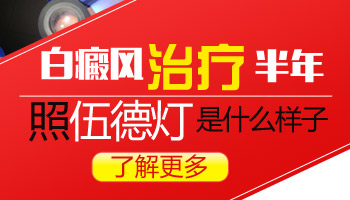 面部長有一片白斑照308激光多久一次,一次多少錢