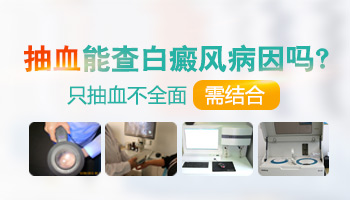 胸部白癜風(fēng)有拳頭大照進(jìn)口308激光一次多少錢