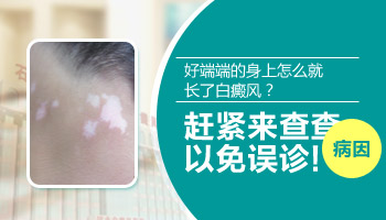 腹部長有一片白斑照308激光多少錢做一次