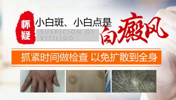 8個月孩子腳上有白點照伍德燈亮白色是不是白癜風