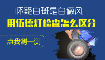 面部白斑有巴掌大照308激光一個療程多少錢
