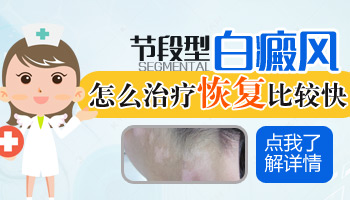 兒童肩膀有白點(diǎn)照uvb一次要多少錢