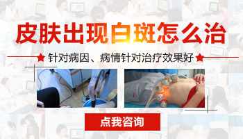 頭部白斑有雞蛋大用308激光治好要多少錢