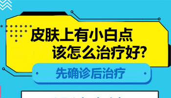 胸部長早期白癜風照進口308激光一次多少錢
