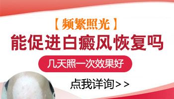 大腿白斑有雞蛋大照308多少錢，長期照射好嗎