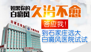 8個月孩子腳上硬幣大白斑伍德燈下皮膚為灰白色是白癜風嗎