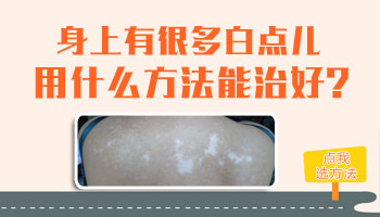 7個月孩子脖子圓形白斑照伍德燈是淡白色是白癜風嗎