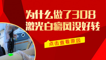 肩膀長早期白癜風照308多少錢,長期照射好嗎