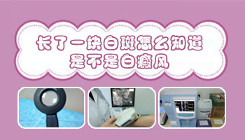 4個月孩子后背有一小塊白斑照伍德燈顯熒光是不是白癜風