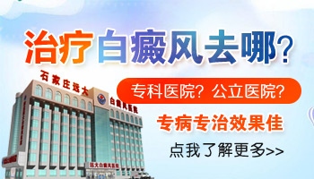 腹部白癜風有拳頭大照進口308激光一次多少錢