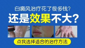 4個月孩子手上有塊白塊怎么回事,需求治療嗎