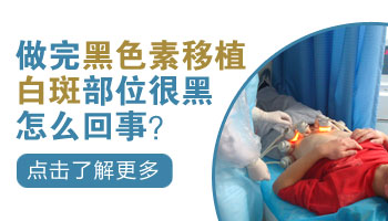 兒童腿上有白塊只照uvb光能控制住嗎